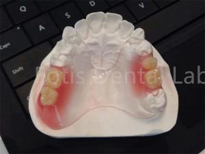 China Flexible TCS Valplast Dental Appliances Comfortable Durable Design wholesale