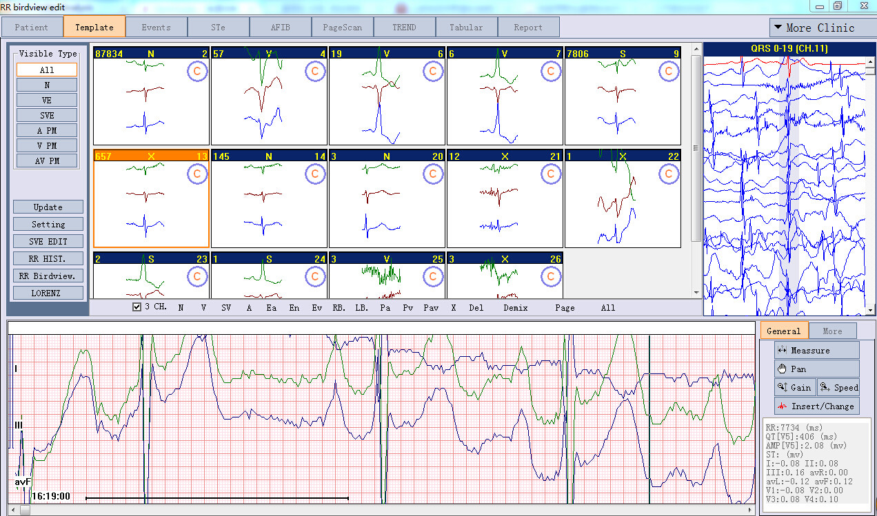 Wearable Ambulatory ECG Patch Monitors single Lead or 3 leads 24-hour Holter, long-term Holter, cardiac event monitoring