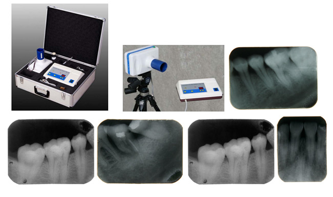 50 / 60 Hz Low Dose Dental X - Ray Unit , Portable X Ray Machine With Clear Image