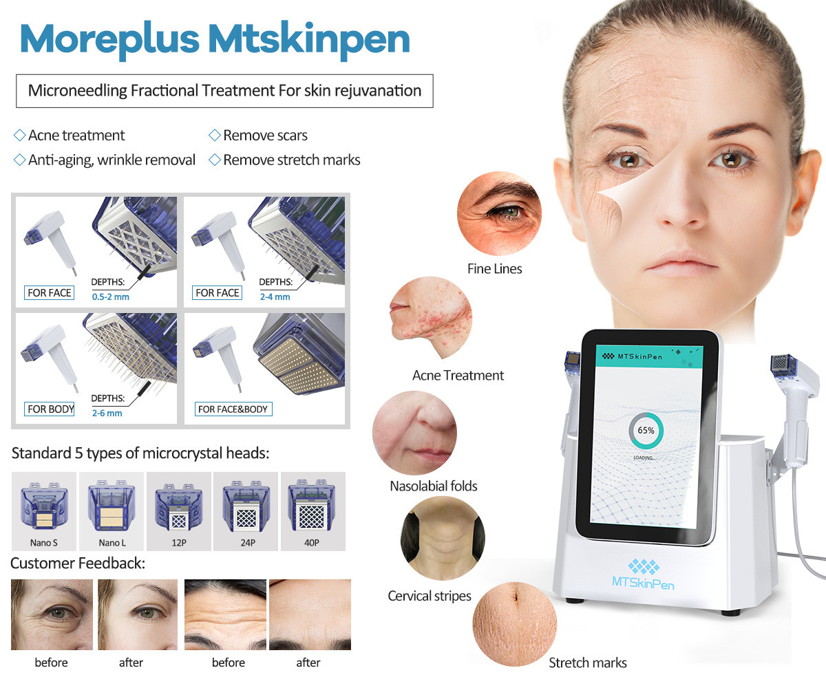 110V-240V Microneedling Machine With Adjustable Needle Depth For Skin Rejuvenation