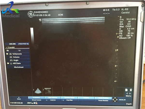 Linear Versatile Compatible Ultrasound Probe GE 8L RS