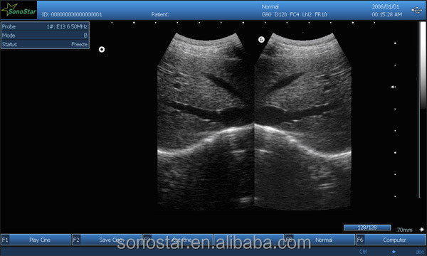 PC based 3D Ultrasound Machine SS-9 Laptop Ultrasound scanner