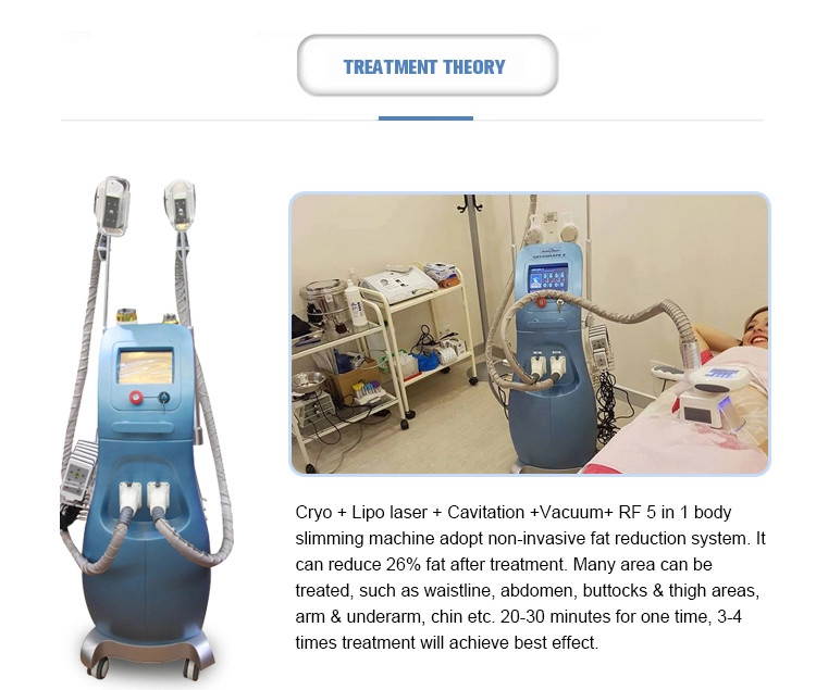 6 in 1 Salon use Multifunction weight loss cavitation rf vacuum cryo lipo laser slimming beauty machine LF-208