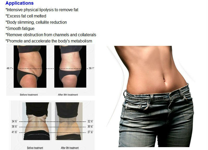 Surgical Laser Liposuction Slimming Machine 980nm 810nm