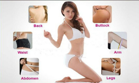 Cryolipolysis slimming equipment Cryolipolysis fat freezing slimming equipment