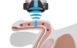 Eswt ED Shockwave Therapy Machine Shock Wave Physical Therapy Equipments