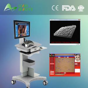 China Best skin pigment analyzer wholesale