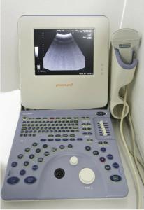 China Aloka Prosound 2 Portable Ultrasound System Original wholesale
