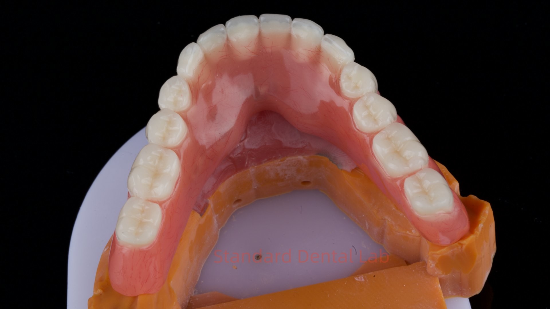 Ivoclar Digital Dental Implant Bar Denture with Attachments Full Acrylic Denture Titanium Implant Supported Dentures