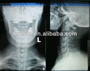 China High Sharpness Medical Diagnostic Imaging , Dry AGFA X Ray Film wholesale