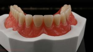 China Dentsply Lucitone 199 Acrylic Denture For Full Arch Natural Look wholesale
