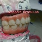 Dental Implant Temporary Crown PMMA Bridge With Pink Porcelian