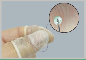 China Stainless Steel Tig Micro Laser Welding For Medical Parts ISO Certification wholesale