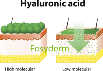 Lips Enhance Hyaluronic Acid Facial Filler With 0.10 - 0.15mm Particle Size