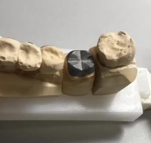China ISO FDA CE Dental Metal Post And Core Crown PFM Good Fit wholesale