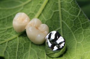 China Metal Framework PFM Dental Crown wholesale