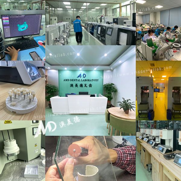 High-Precision Wax Rim and Bite Block for Denture Jaw Relation Recording