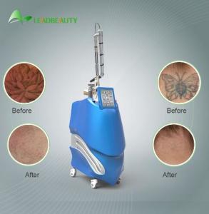 China 600ps pico second Nd:YAG laser for tattoo removal beauty equipment +86 18332565274 wholesale