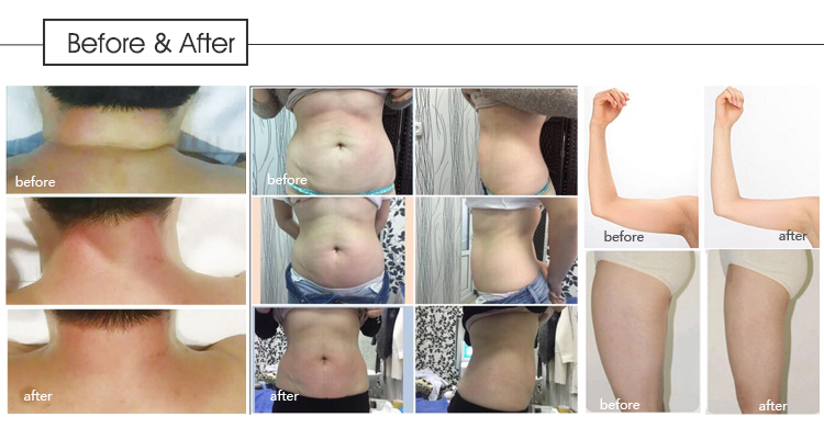 Vacuum Roller Massage Machine , Infrared RF Vacuum Roller Slimming Machine