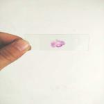 Human Diseases 15pcs Prepared Microscope Slides For Hospital Research