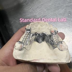 China Cobalt Chrome Cast Frame Partial Denture Vitallium 2000 wholesale