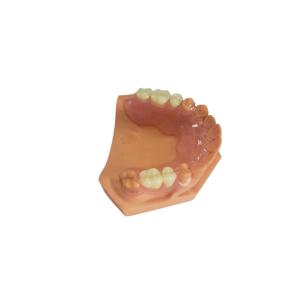 China 3D Printed Dentures For Dental Labs Based On Digital Data wholesale
