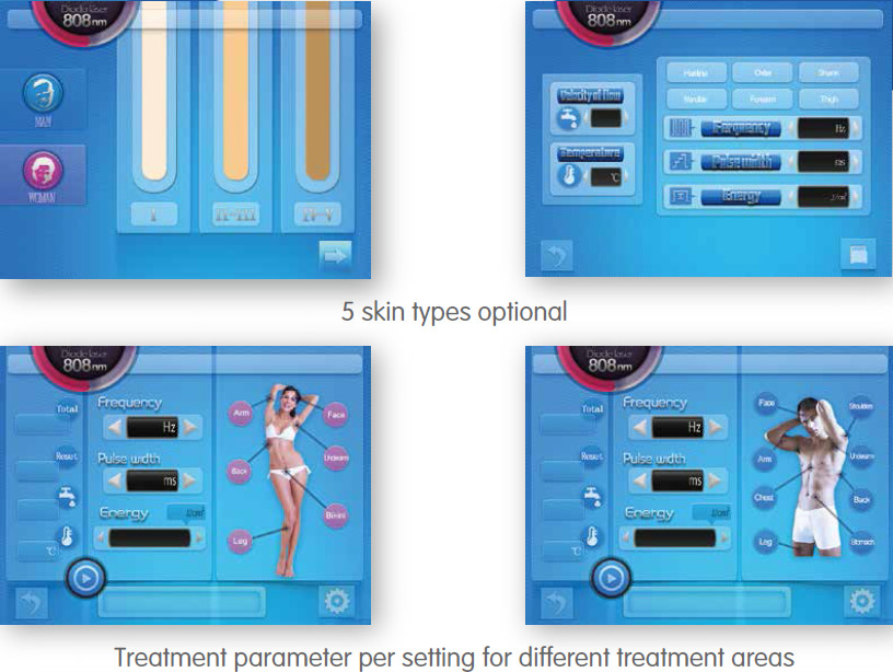 Soprano XL! 600W Germany Laser Portable 808nm Diode Laser Hair Removal Machine
