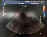 S5-1 Replace Lens Connecting Cable 2D Probe Repair
