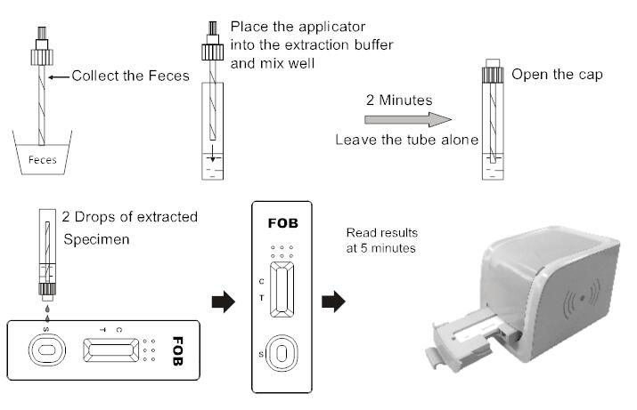 Citest Fast LF Reader Sensitive Accurate Calprotectin FOB Rapid Test Reader