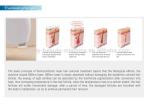 2018 hottest Beijing Nubway effective 2000W high power skin tightening 808nm