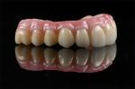 China Dental Lab All On 4 Bridge Full Arch Implant Bridge In Demistry