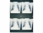 KND-A / F Medical X Ray Films