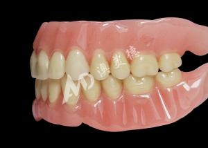 China Affordable Full Arch Acrylic Dentures for Comfortable Removable Dentures wholesale
