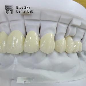 China Translucent Layered Zirconia Crown Dental Restoration Multilayer Zirconia Crown wholesale