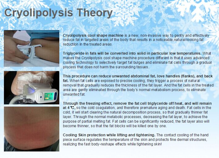 Cryolipolysis theory.jpg