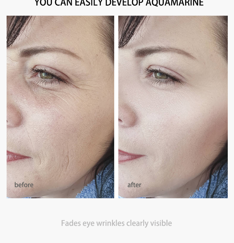 Hydrating Anti Puff Eye Cream Eyecare Cosmetics OEM Skin Care Products