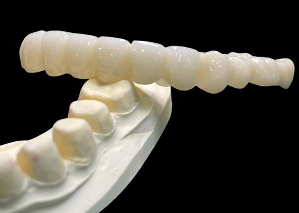 Vita Classical Shade All Ceramic Crown Bridge Natural Looking For Dental