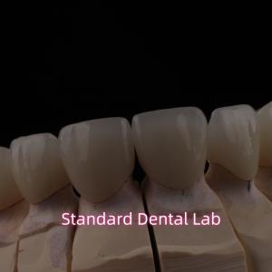 China PFZ Dental Layered Ceramic Zirconia Bridge With Incisal Translucent wholesale