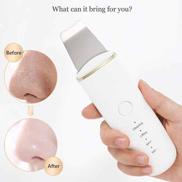 Portable Ultrasonic Facial Cleansing Spatula Pore Acne Blackhead Skin Peeling Machine 1.5W