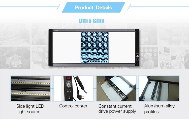 Hot Sale Manufacturer Supply LED Medical X-ray Film Viewer