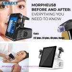 Rf Fractional Microneedling Machine , Morpheus 8 Price Machine