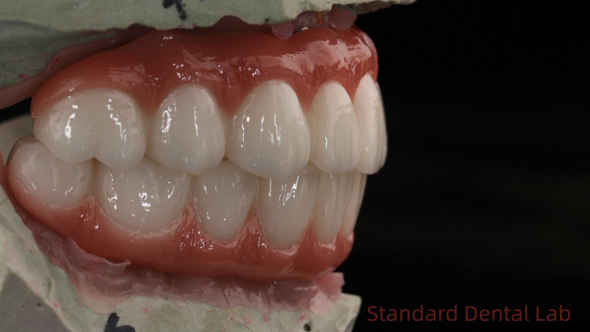 High Quality Dental zirconia crown and All On Four Six Implant Full Arch / China dental lab Manufacturer