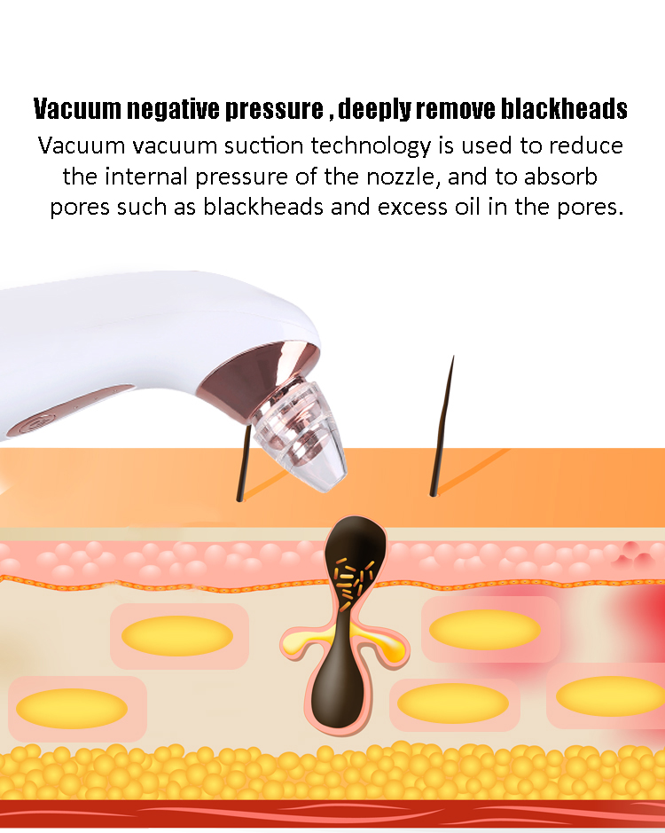 Eco Friendly Electric Blackhead Remover Tool Beauty Skin Acne Rejuvenation