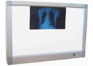 China Aluminum Alloy X Ray Viewer for Two Films Medical X Ray Machine wholesale