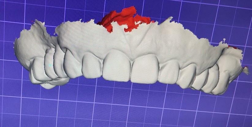 CAD CAM Design Digital Display Mockup Teeth Other Dental Products