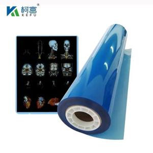China High Definition And Wide Gamut Medical Laser Film 17x22in 0.17mm For Detailed And Vivid Medical Examinations wholesale