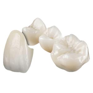 China Aesthetically Stable Zirconia Ceramic Crown Non Irritating Implant Crown wholesale