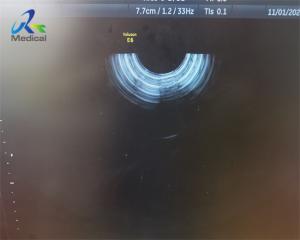 China GE RIC5-9-D Ultrasound Probe Repair 4D Replace Dome wholesale