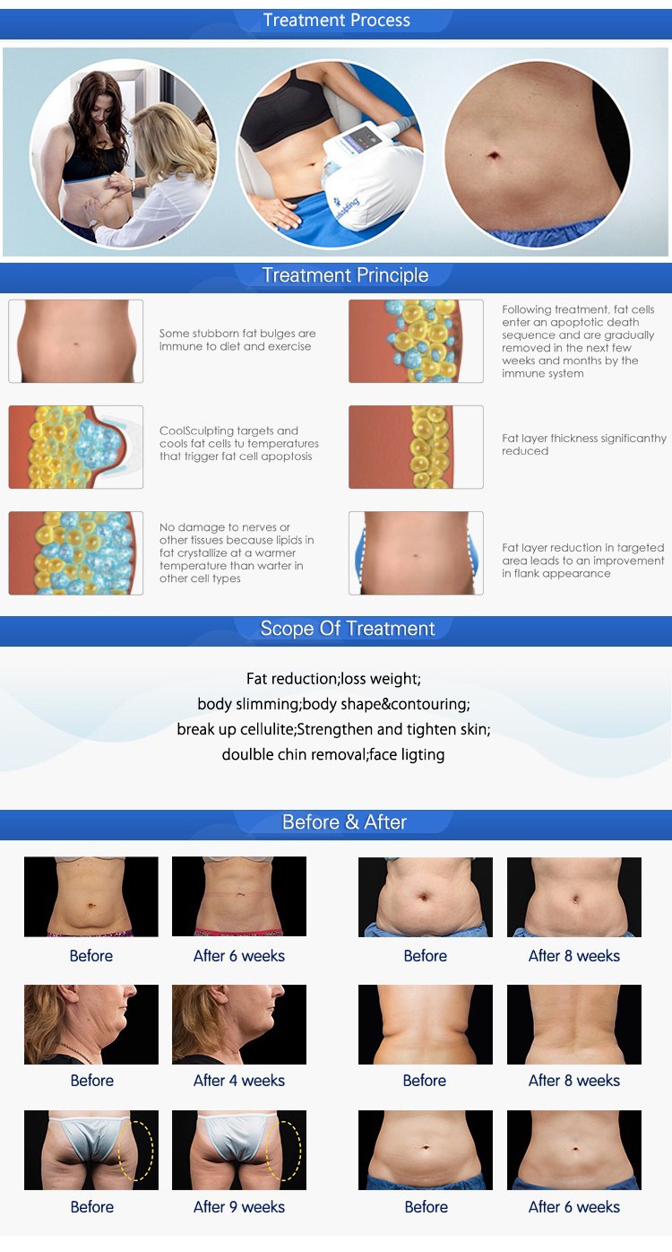 Cryo+ vacuum+ RF + Cavitation multifunctional machine for body slimming and weight loss, skin rejuvenation