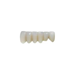 China OEM Implant Zirconia Dental Crown Fixed Bridge wholesale